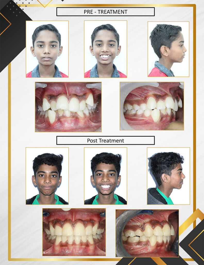 result 2 (1)