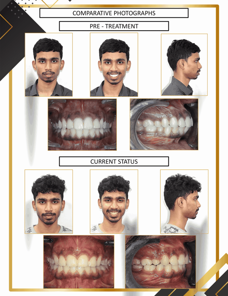 result1 (3)