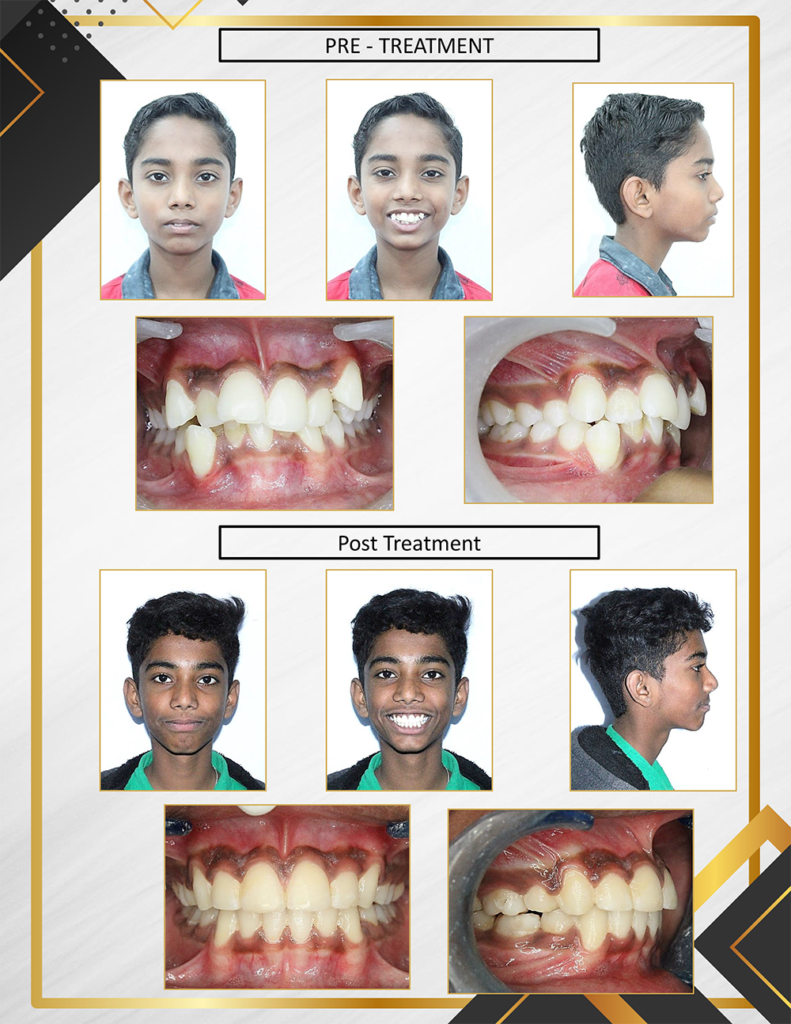 result2.2