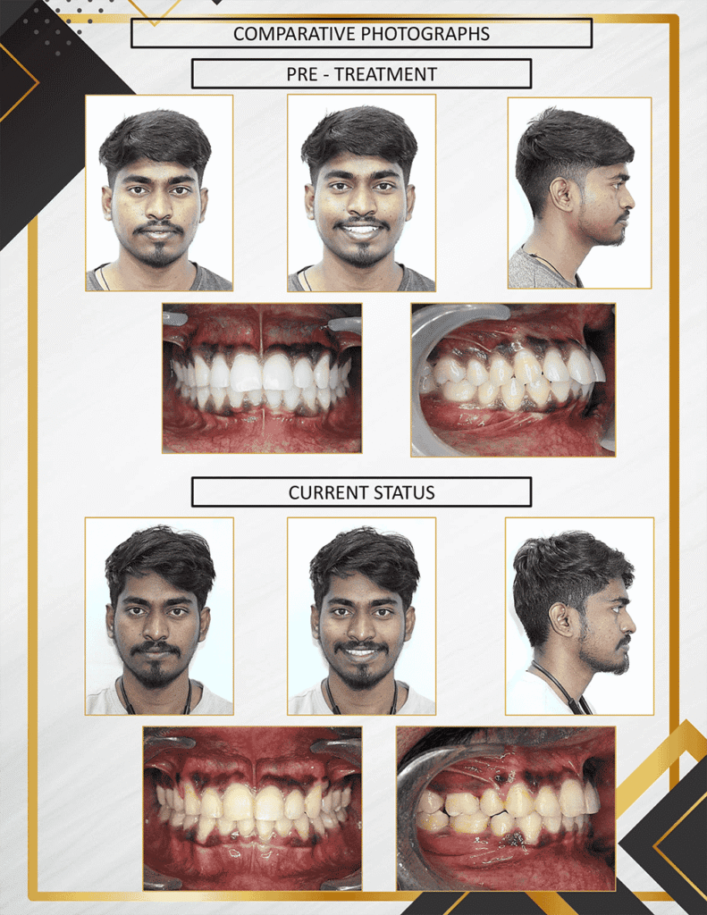 result3 (1)