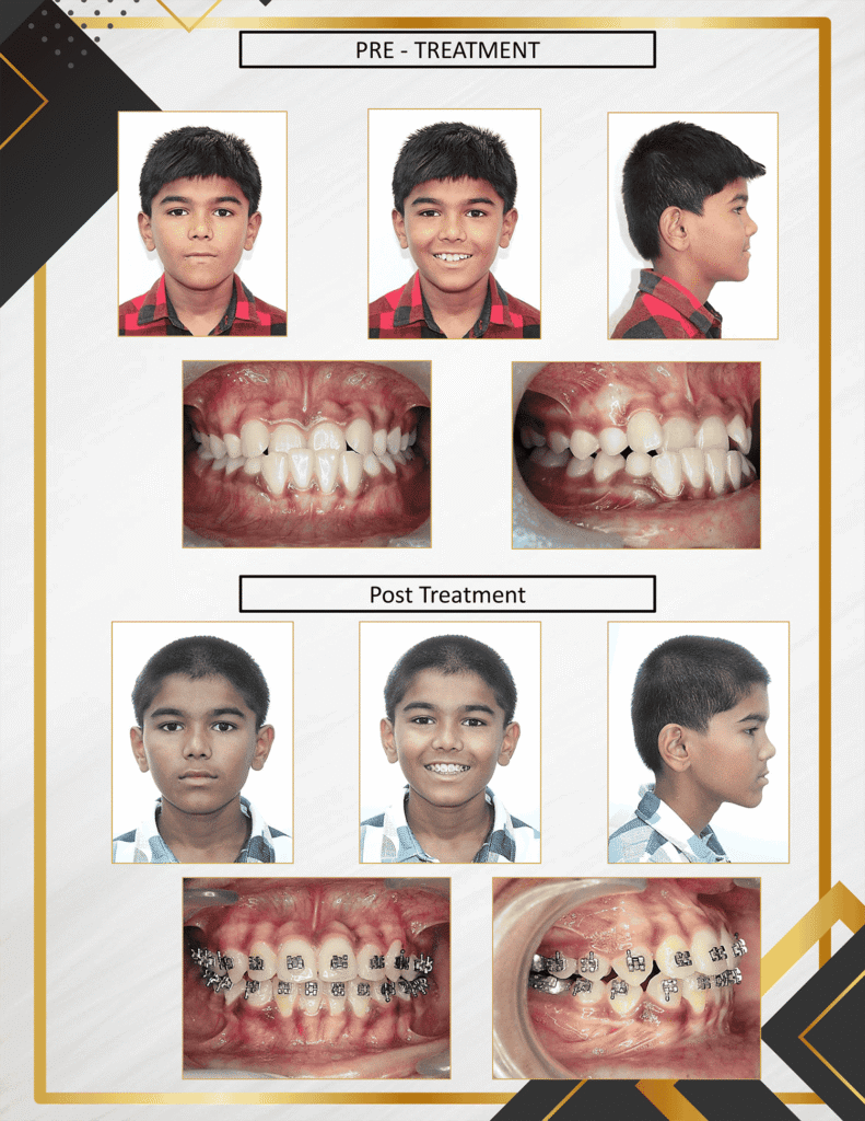 result4 (1)